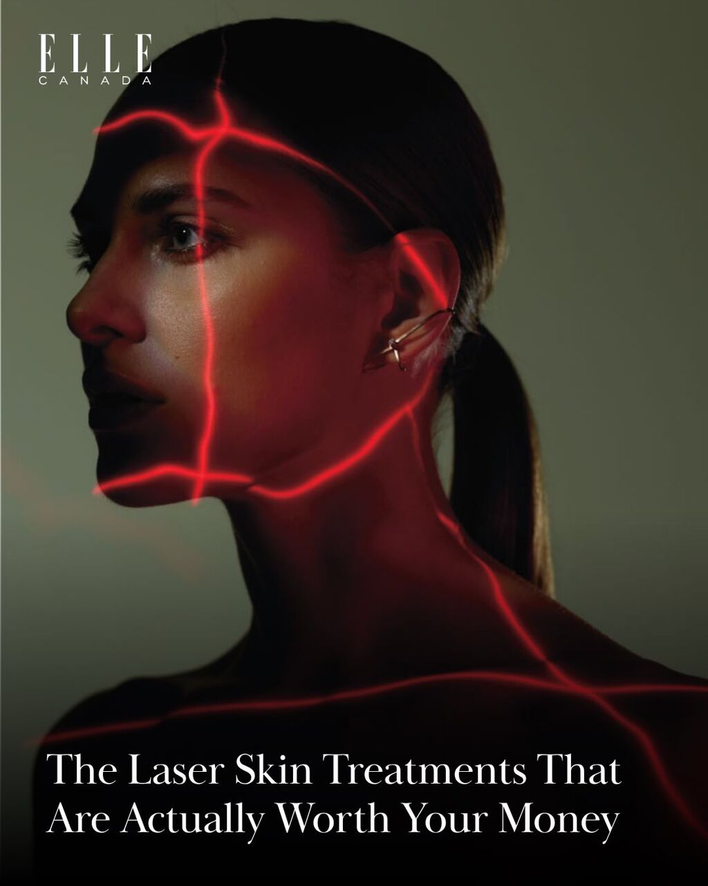 The Laser Skin Treatments That Are Actually Worth Your Money