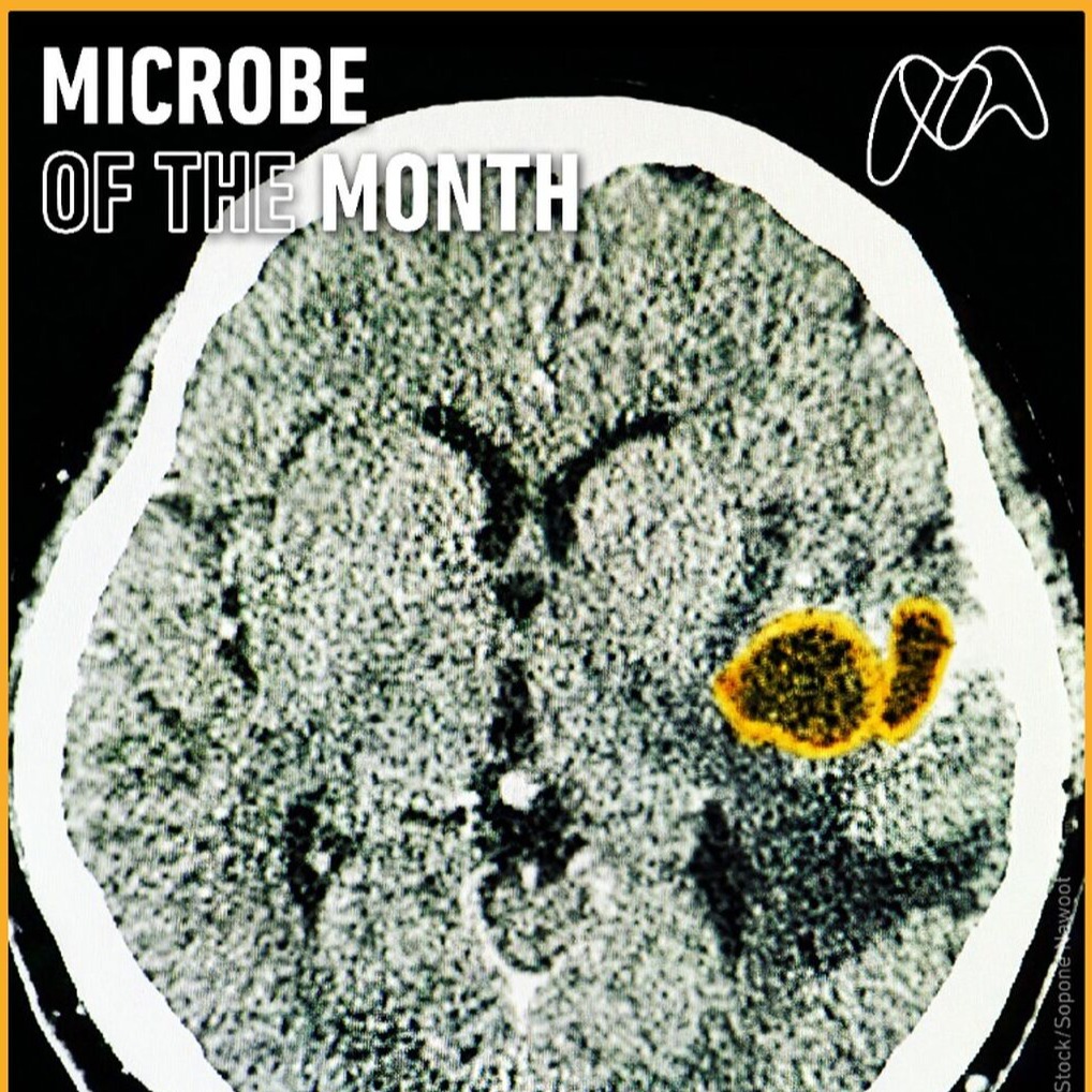 Microbe of the Month - July 2026