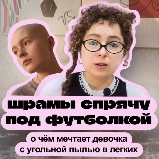 Шрамы