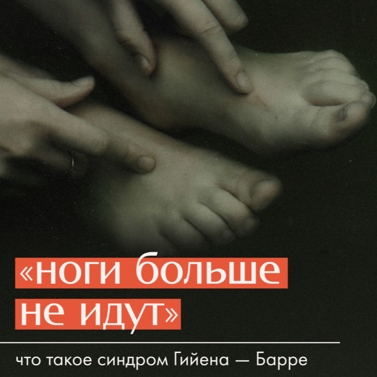 Синдром Гийена &mdash; Барре