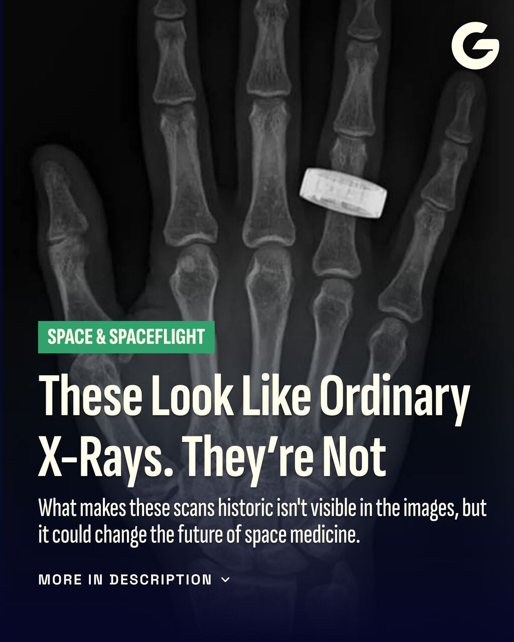 These Look Like Ordinary X-Rays. They&rsquo;re Not
