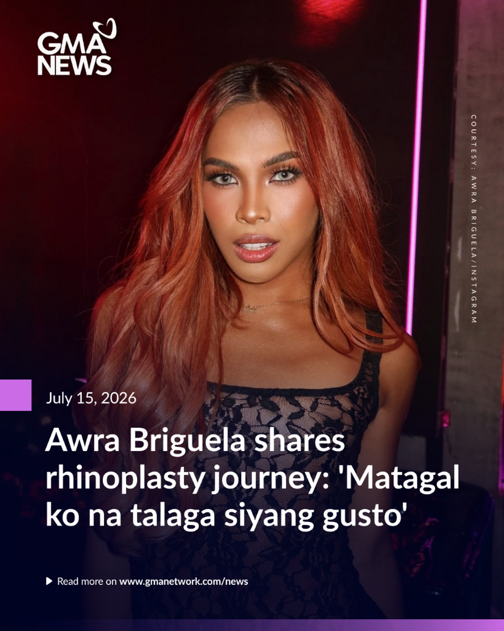 Awra Briguela shares rhinoplasty journey: 
