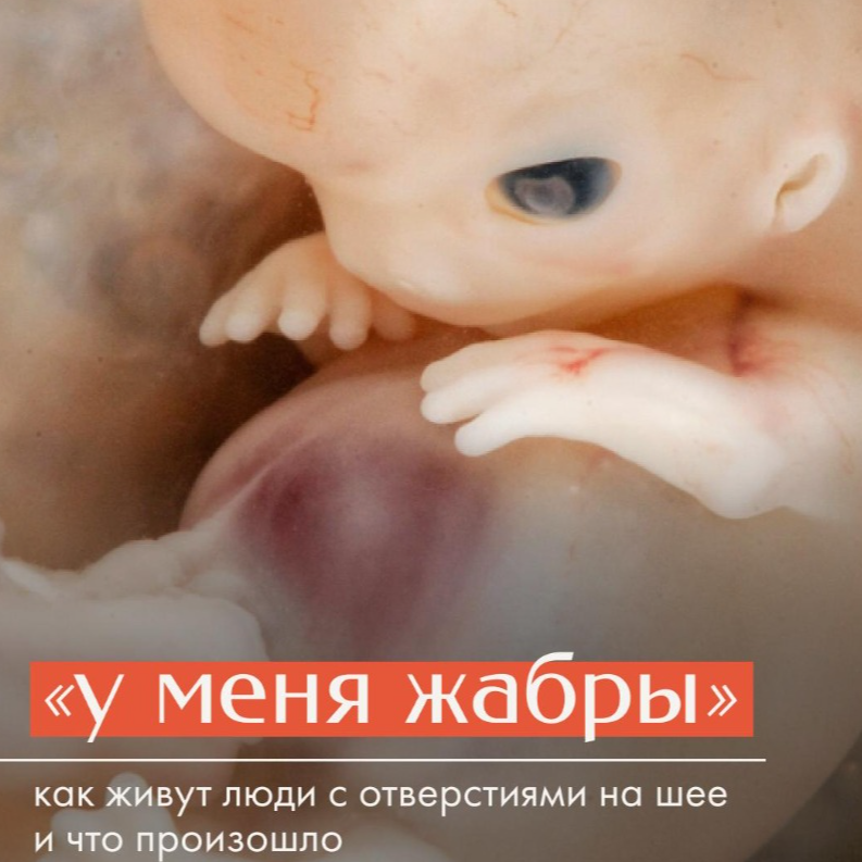 У меня жабры