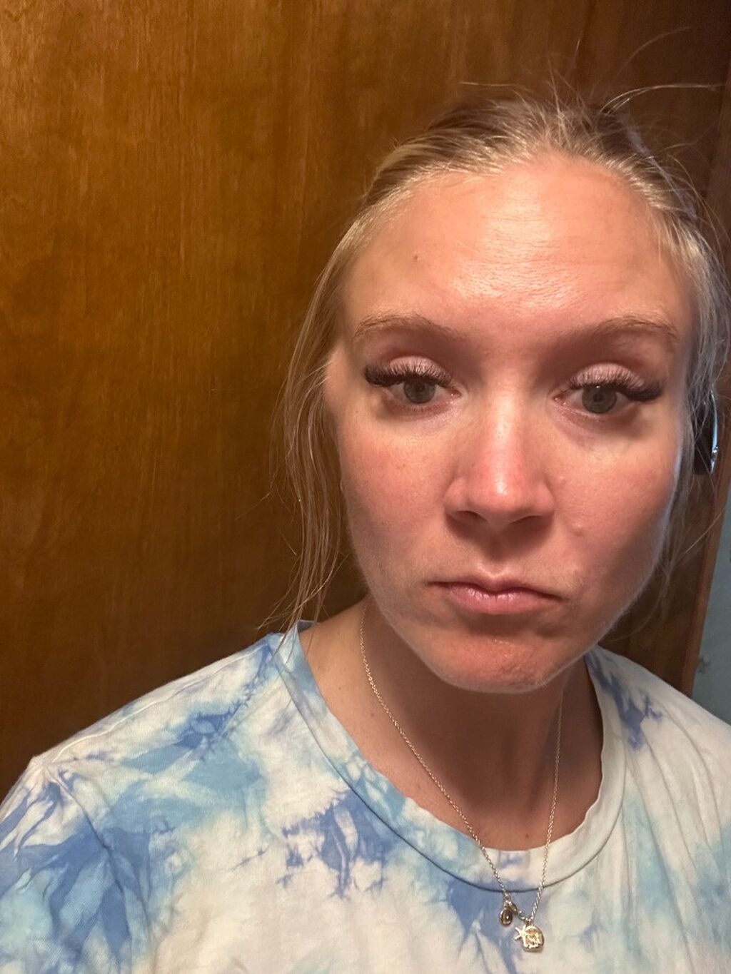 Diagnosed With Leiomyosarcoma: The RARE CANCER Symptom I Couldn't Ignore