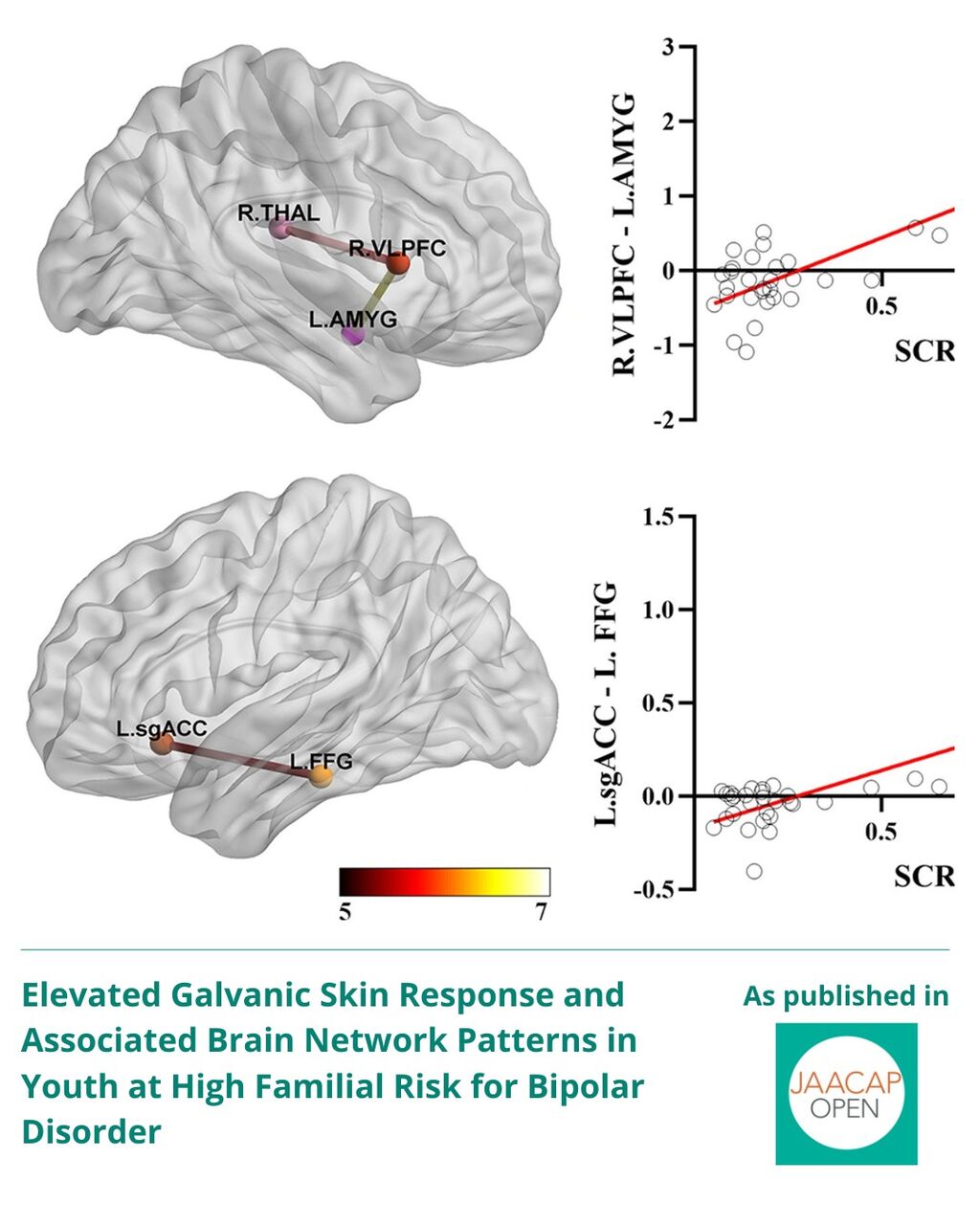 JO AIP Elevated Galvanic Skin Response and Associated Brain Network Patterns in Youth at High Familial Risk for Bipolar Disorder