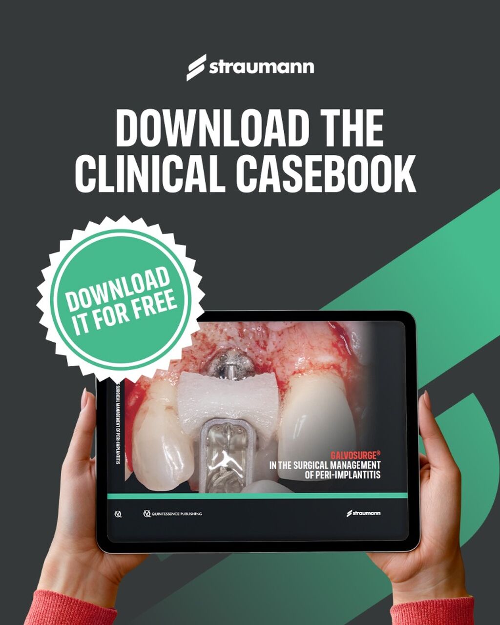  New GalvoSurge&reg; Clinical Casebook