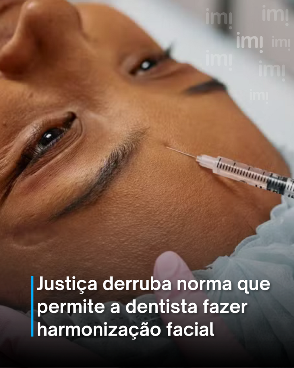 Justi&ccedil;a derruba norma que permite a dentista fazer harmoniza&ccedil;&atilde;o facial