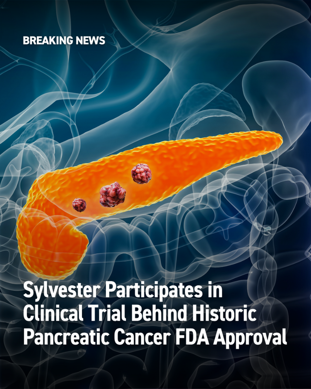 FDA Approval Opens New Chapter in Pancreatic Cancer Treatment - InventUM