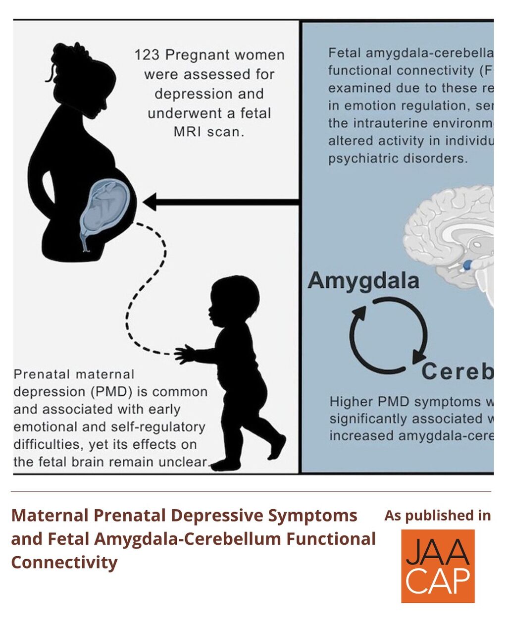 Maternal Prenatal Depressive Symptoms and Fetal Amygdala-Cerebellum Functional Connectivity