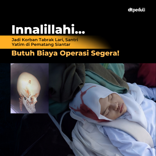 Santri Rumah Peduli Yatim Pematang Siantar Butuh Bantuan Operasi Setelah Kecelakaan