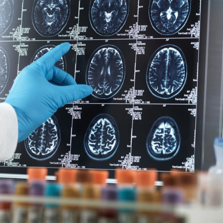 World Alzheimer's day 2026