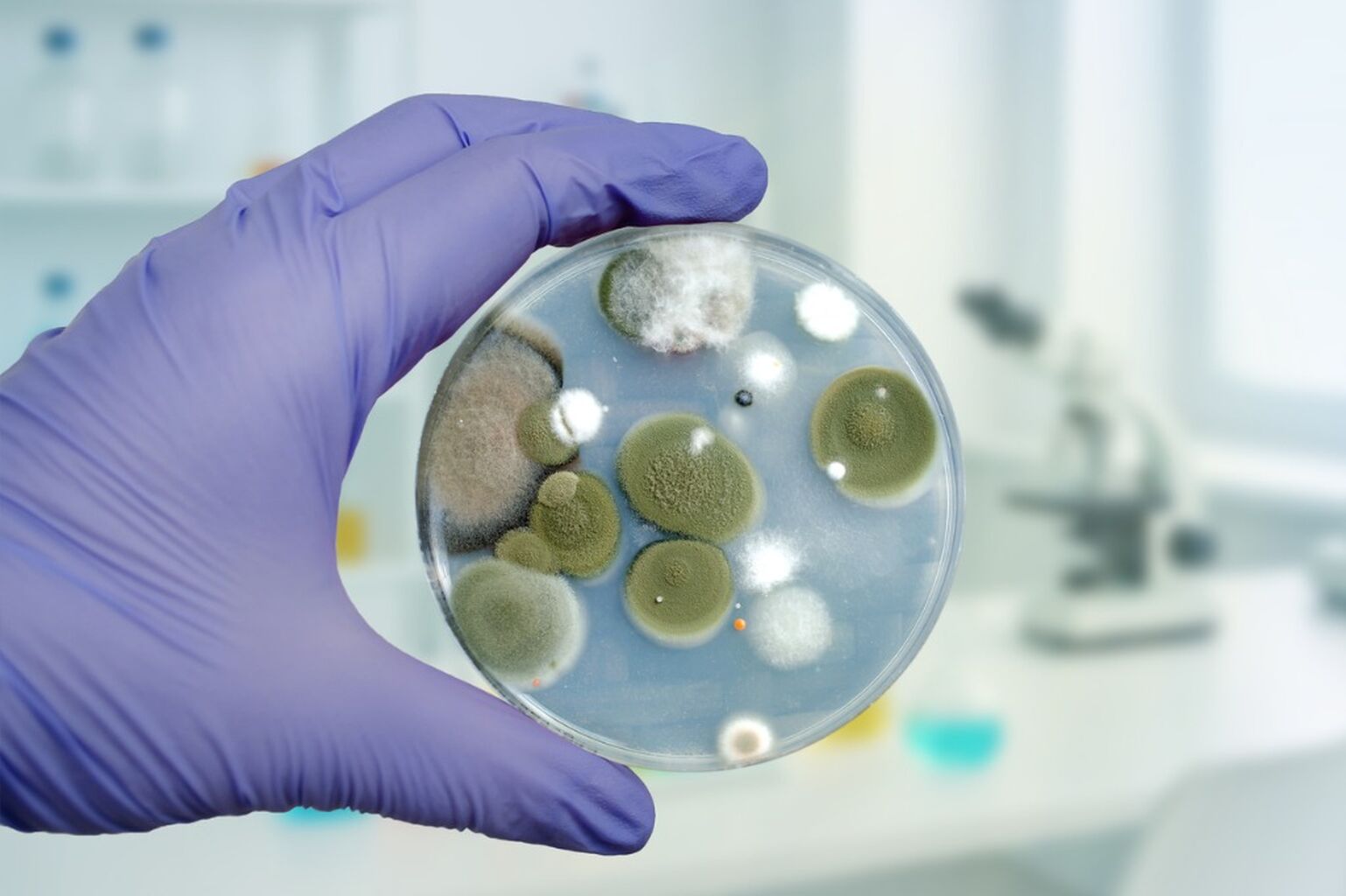 Penicillin discovered by Alexander Fleming (1928)