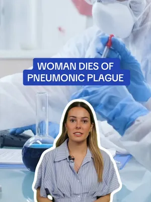 Woman dies of pneumonic plague