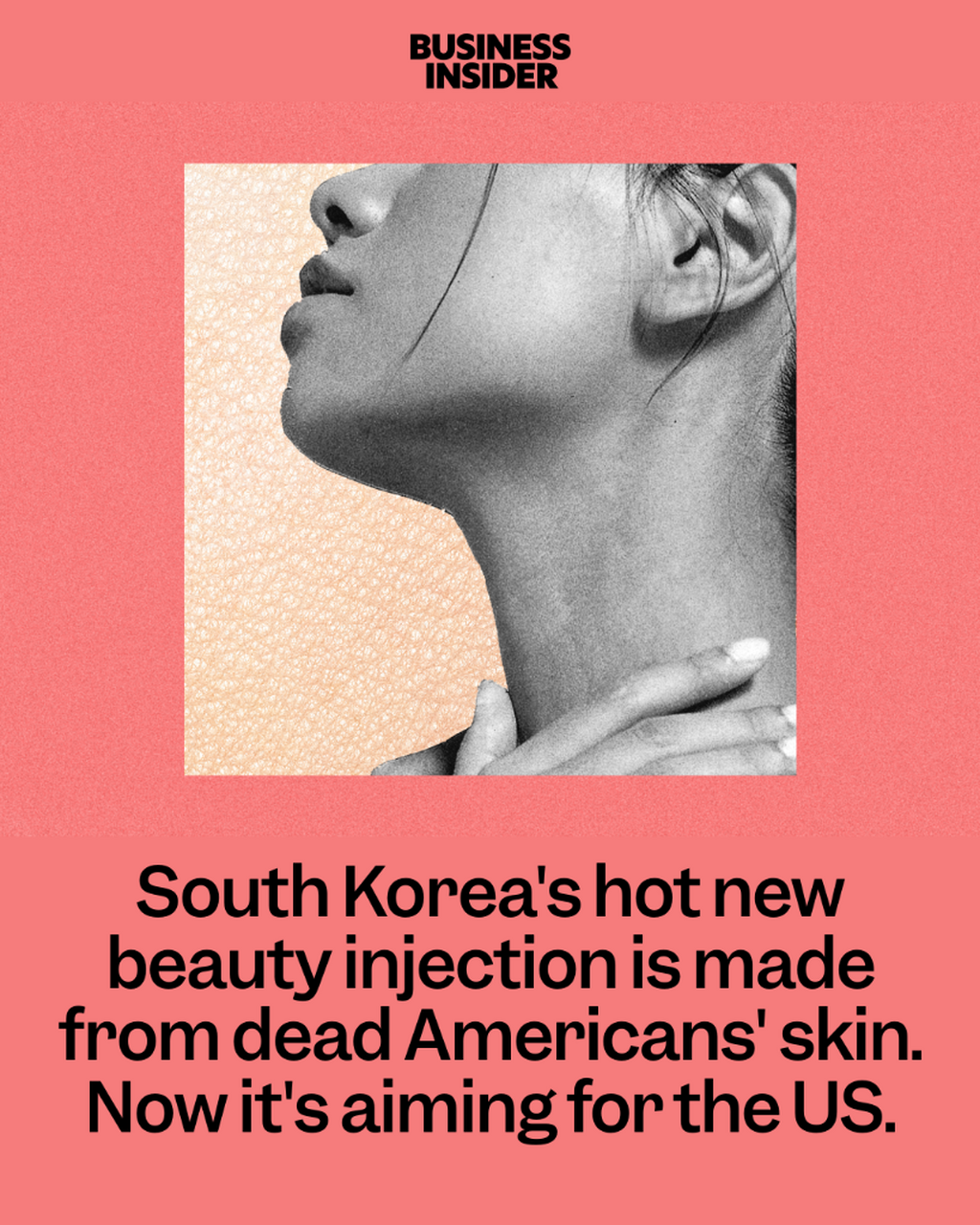 South Korea's hot new beauty injection is made from dead Americans&rsquo; skin. Now it&rsquo;s aiming for the US.
