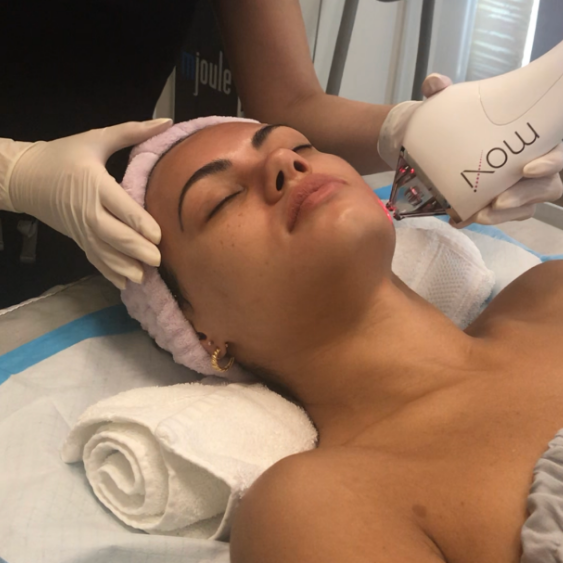 Moxi Treatment