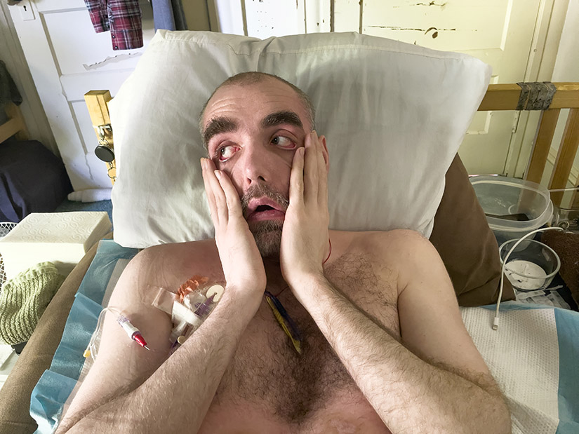 What ME/CFS Patients Often Go Through