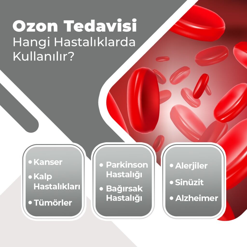 Ozon Tedavisi