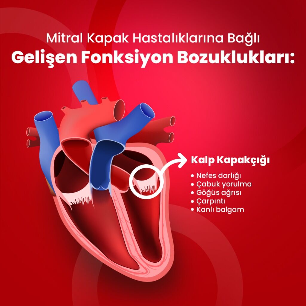 Mitral Kapak Hastalıkları