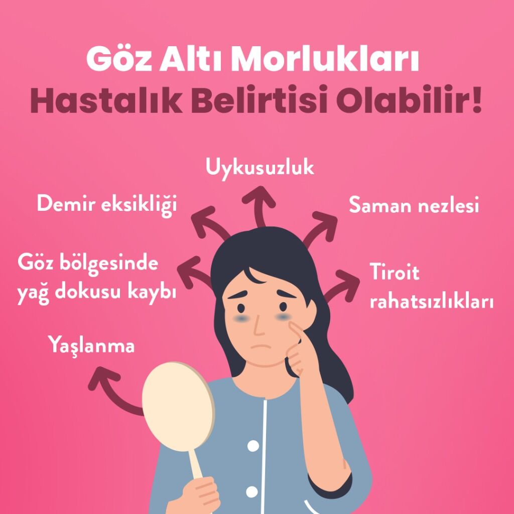 G&ouml;z Altı Morlukları
