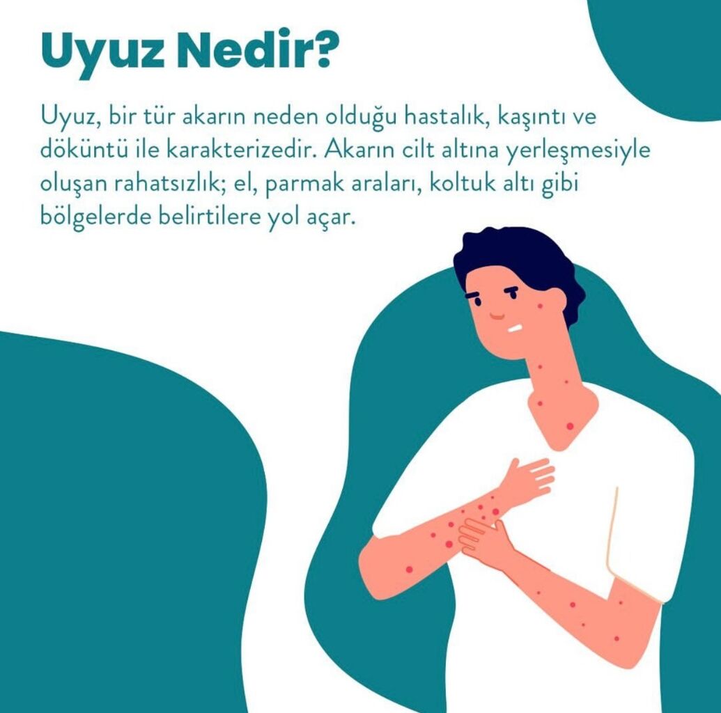 uyuz