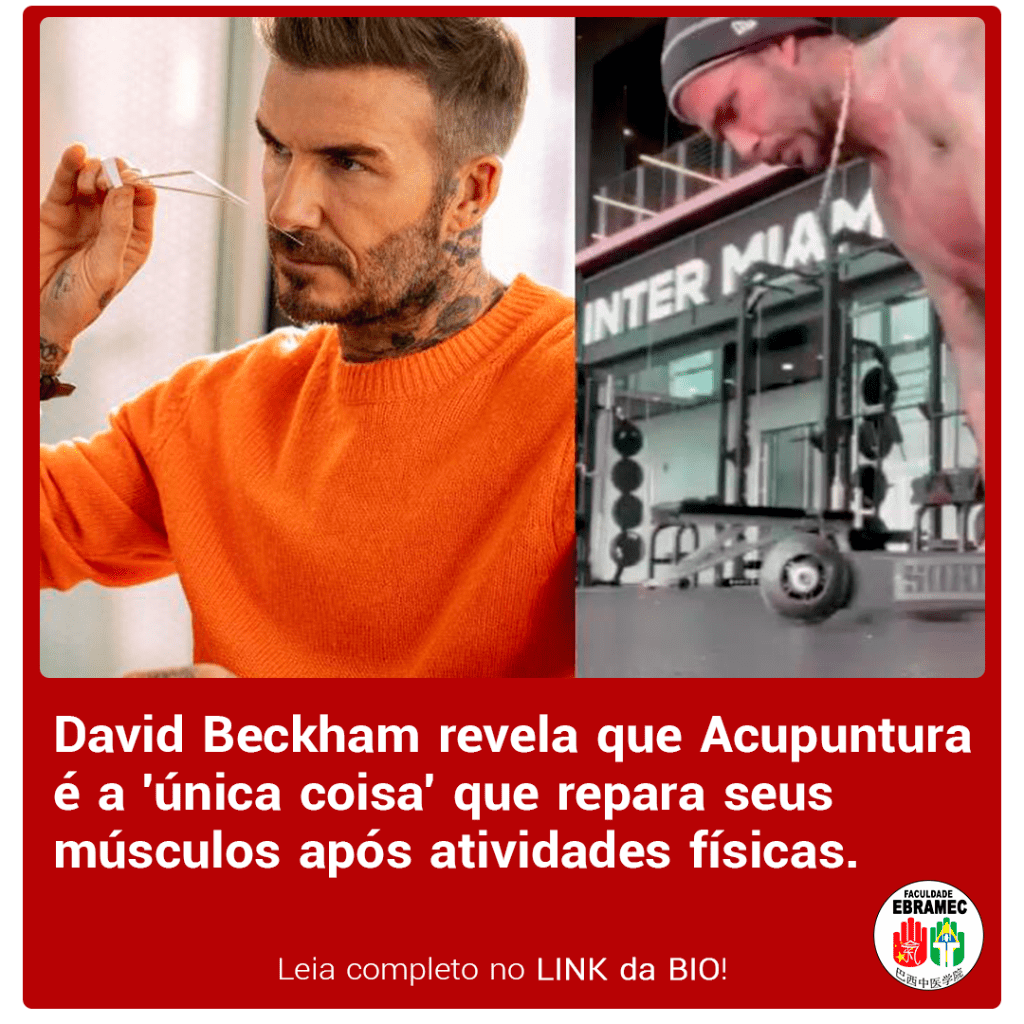 David Beckham revela que a Acupuntura &eacute; a '&uacute;nica coisa' que repara seus m&uacute;sculos ap&oacute;s atividades f&iacute;sicas