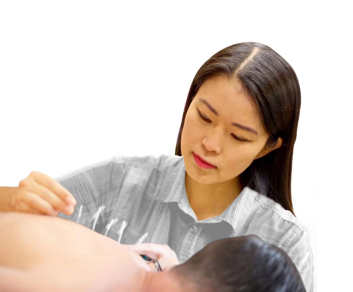 Book Acupuncture session 