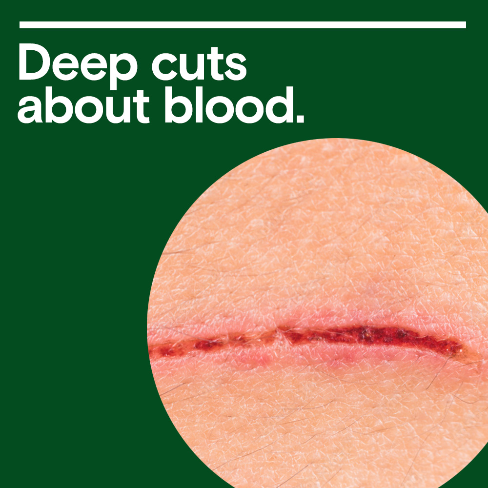 What is blood: from the basics to the deep cuts
