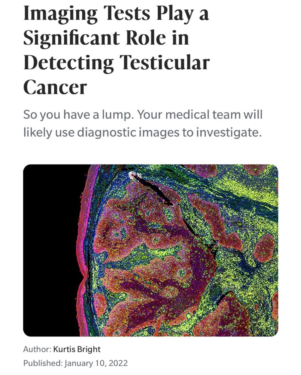 Imaging and testicular cancer