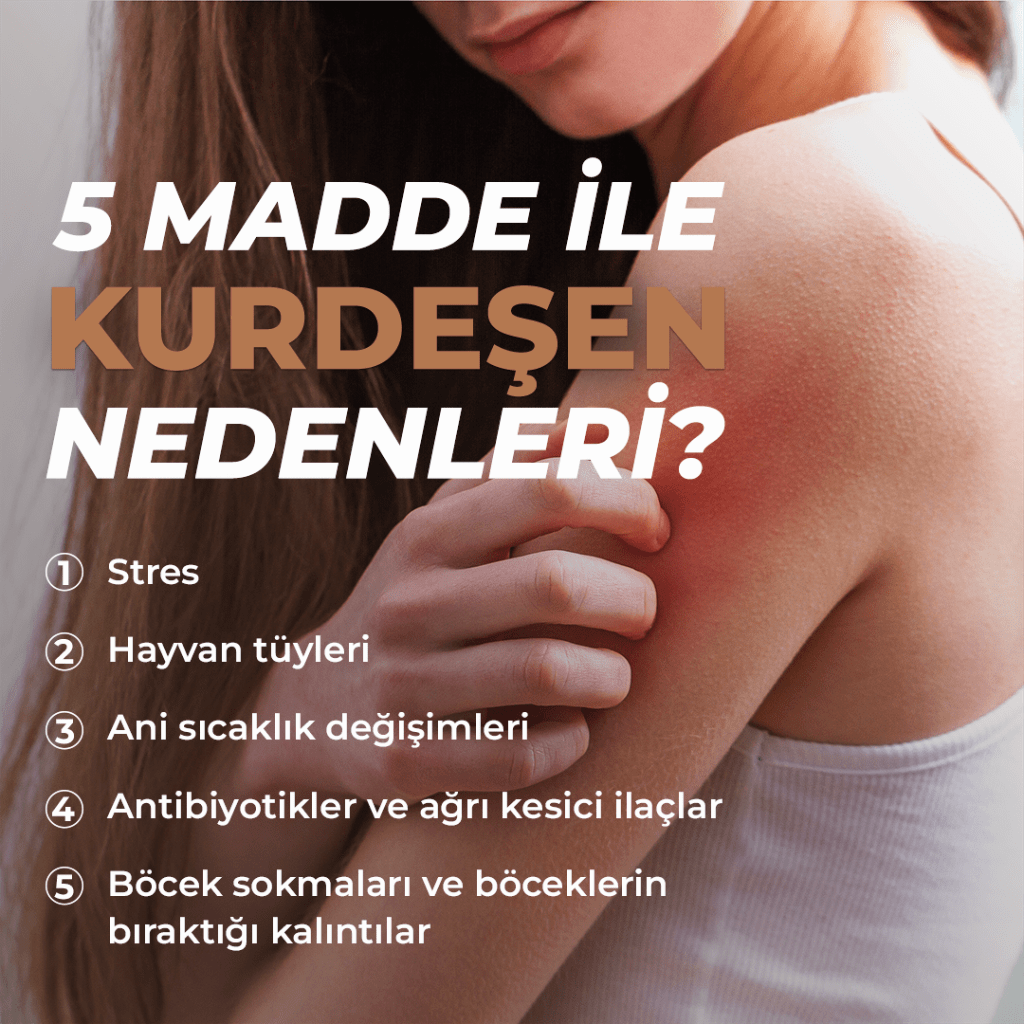 kurdeşen