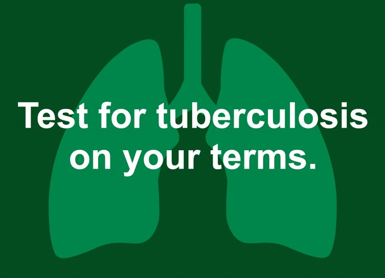 Tuberculosis Blood Test vs. Skin Test