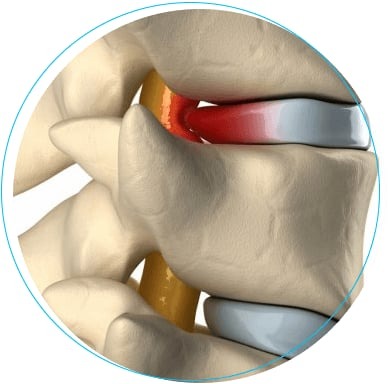 I&rsquo;m going to show you the root cause of your back pain or sciatica and how to fix it.