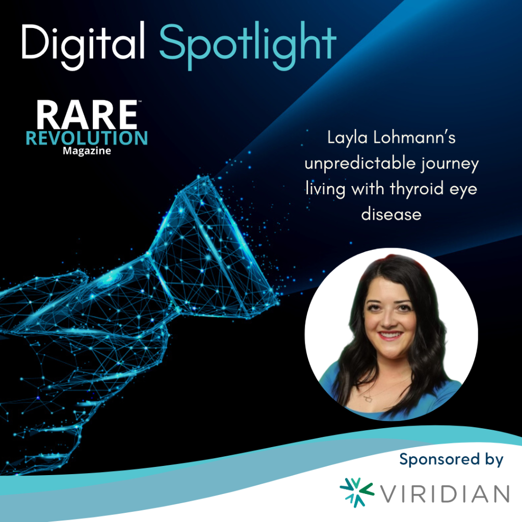 https://rarerevolutionmagazine.com/digitalspotlight/layla-lohmanns-unpredictable-journey-living-with-thyroid-eye-disease/ 
