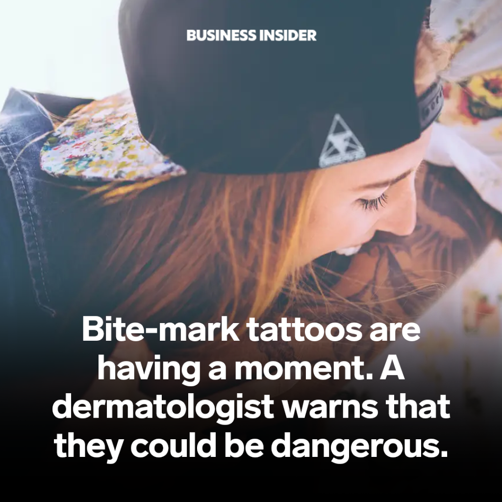 Bite-mark tattoos are having a moment. A dermatologist warns that they could be dangerous.