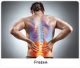 Fix Your Back Pain + Sciatica