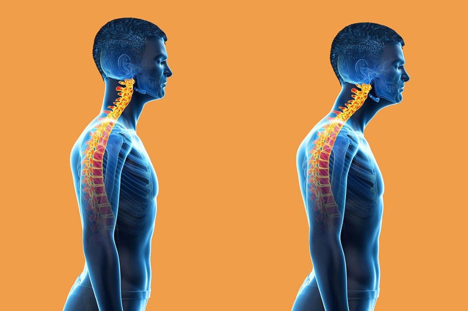 Neck Pain (Forward Head Posture FIX)