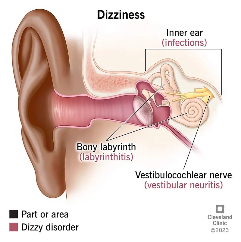 Treat All Types of Vertigo and Dizziness
