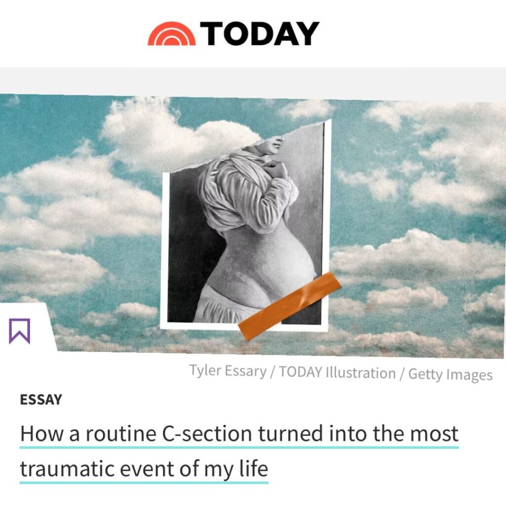 TODAY Essay: Traumatic C-section