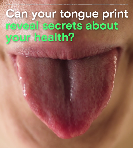 Can your tongue print spill the tea on your health?