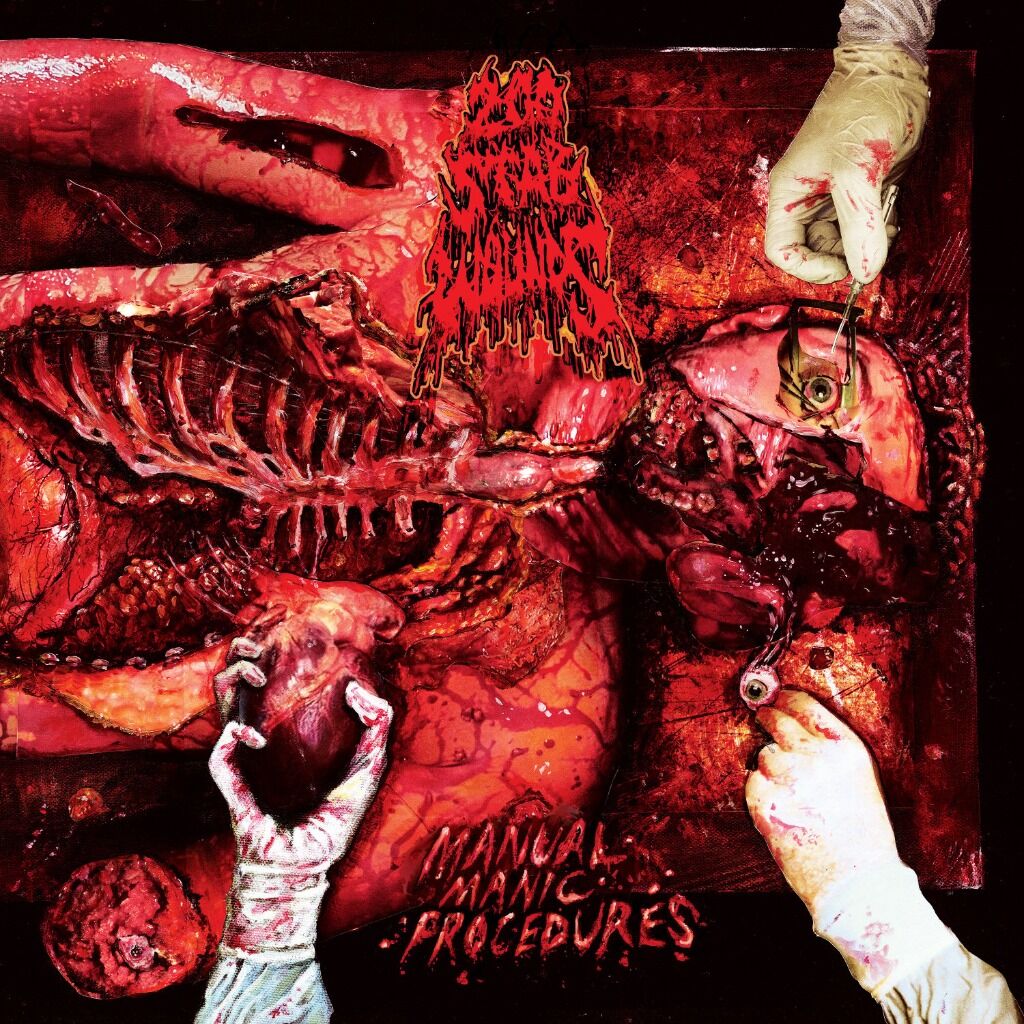 200 STAB WOUNDS - Gross Abuse