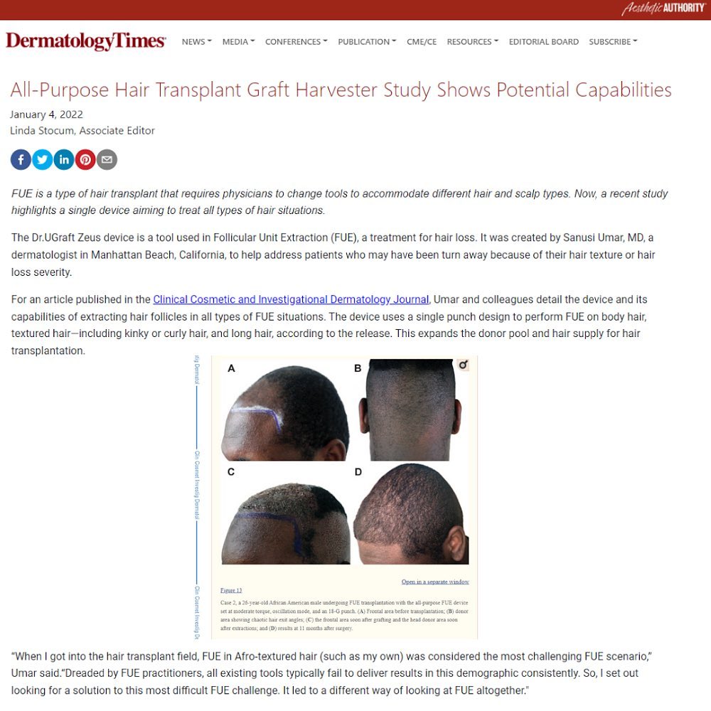 Dermatology Times: All-Purpose Hair Transplant Graft Harvester Study Shows Potential Capabilities