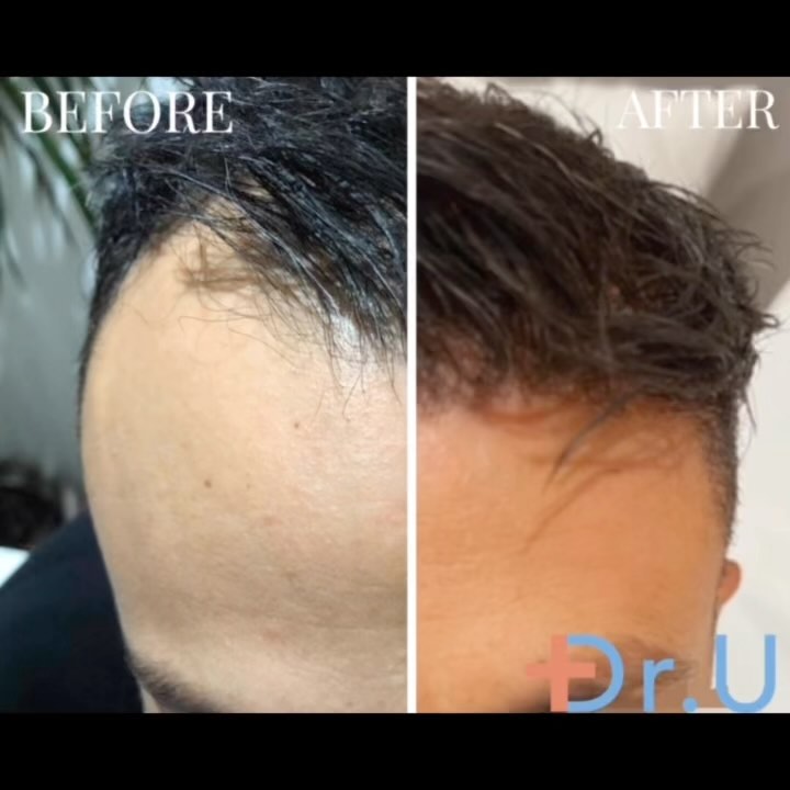 Dr. U Hair Surgery