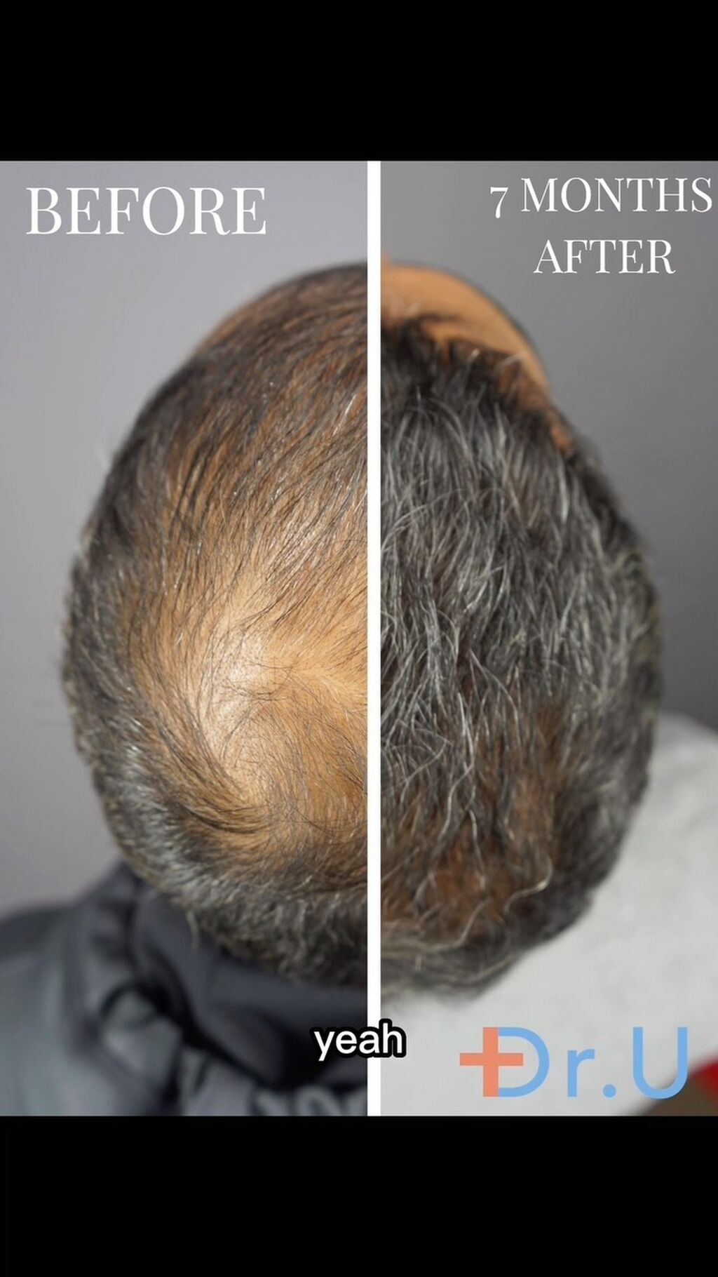 Dr. U Hair Surgery