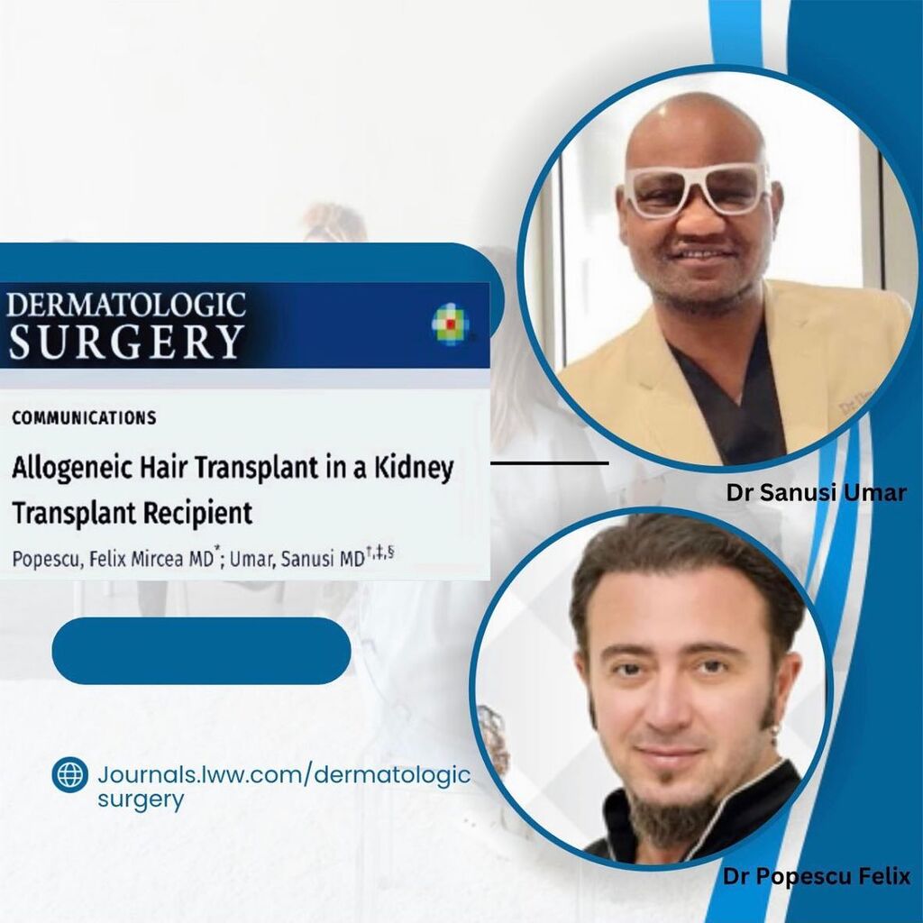 Allogeneic Hair Transplant in a Kidney Transplant Recipient