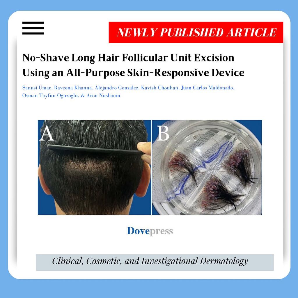 No-Shave Long Hair Follicular Unit Excision Using an All-Purpose Skin-Responsive Device