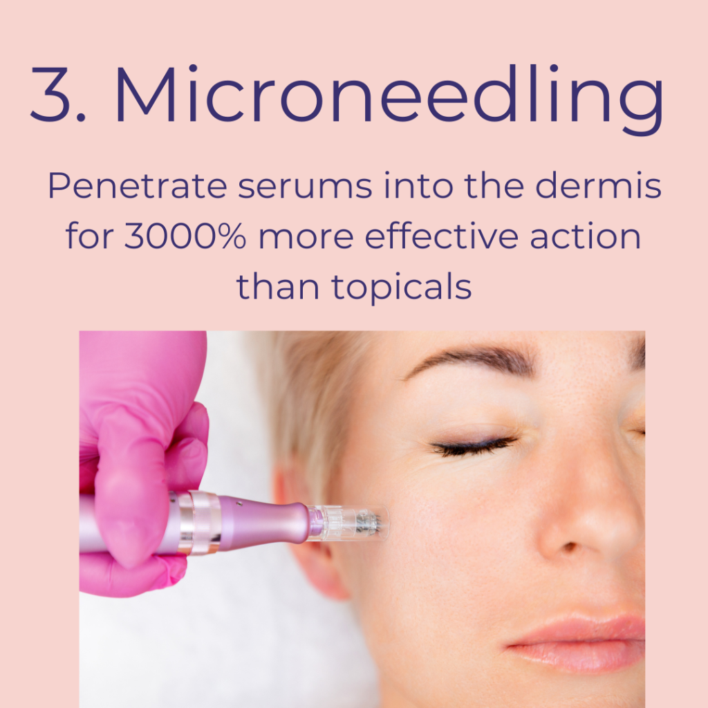 Micro-needling Blog & Sessions