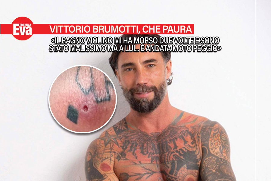 Vittorio Brumotti, morso due volte da un ragno violino
