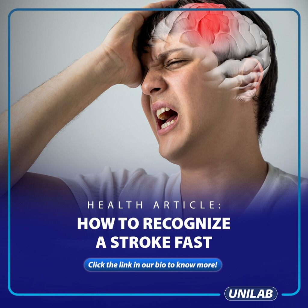 How to Recognize a Stroke FAST