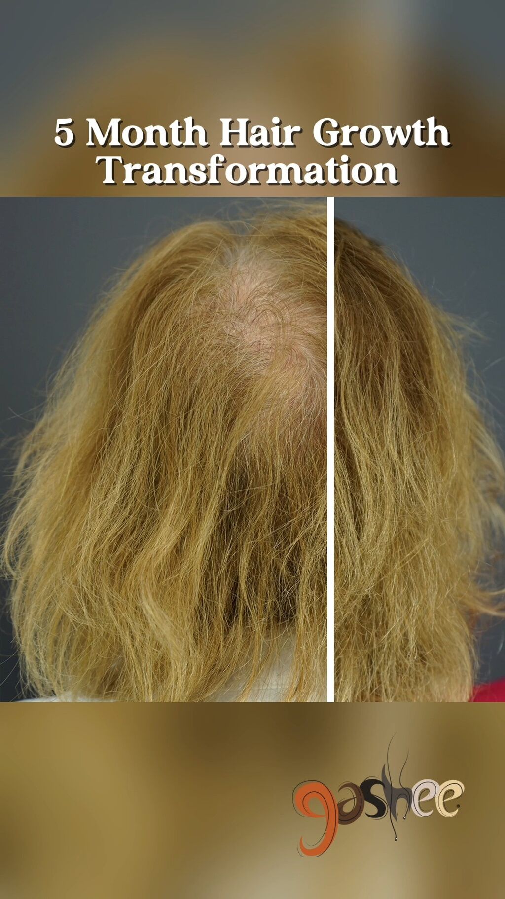 GASHEE Hair Stories: Hair Growth in 5 Months