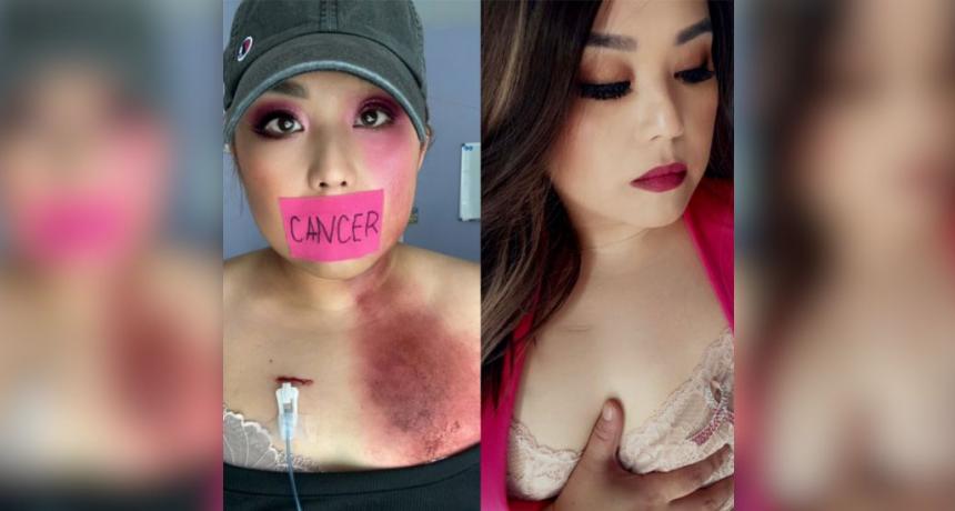  Meet Ria Despi: Skin Cancer & Breast Cancer Survivor |...