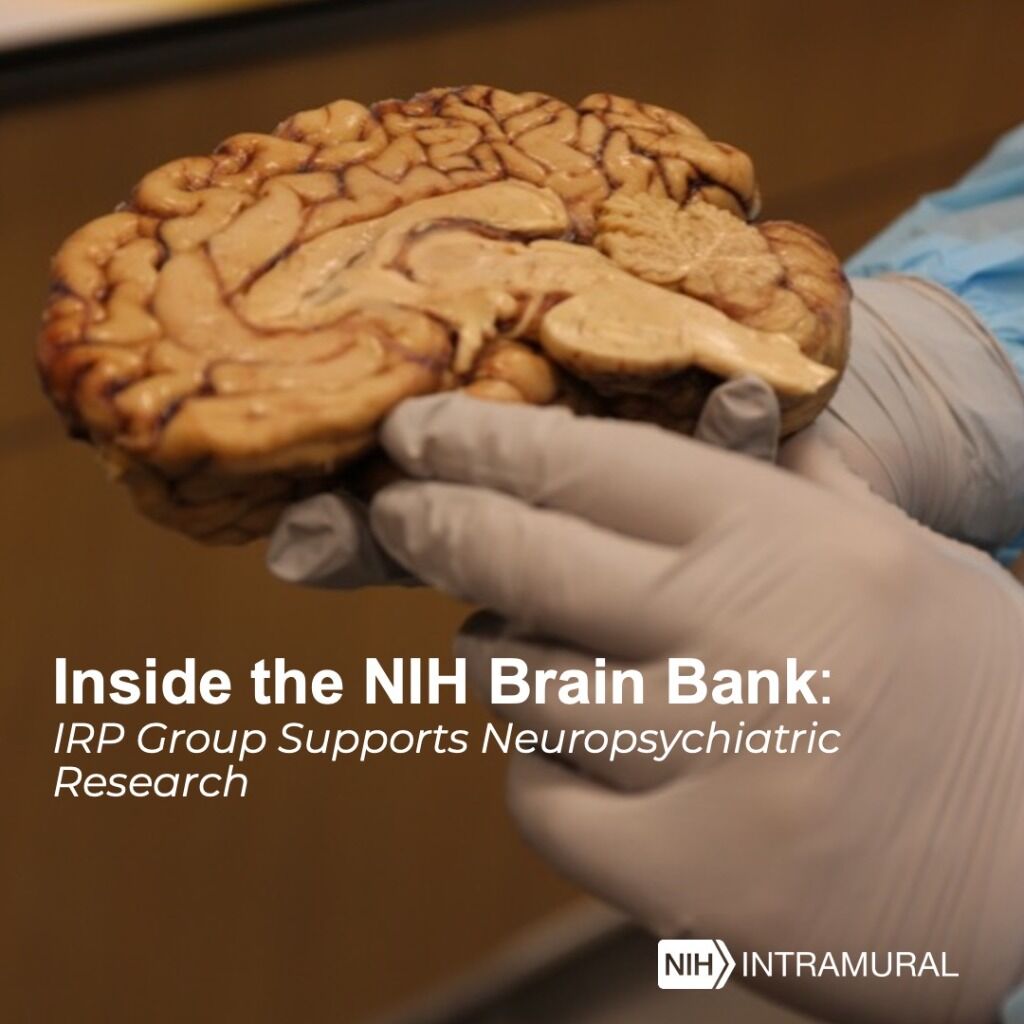 Inside the NIH Brain Bank